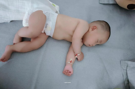 扬中宝宝褶皱处擦粉还是油